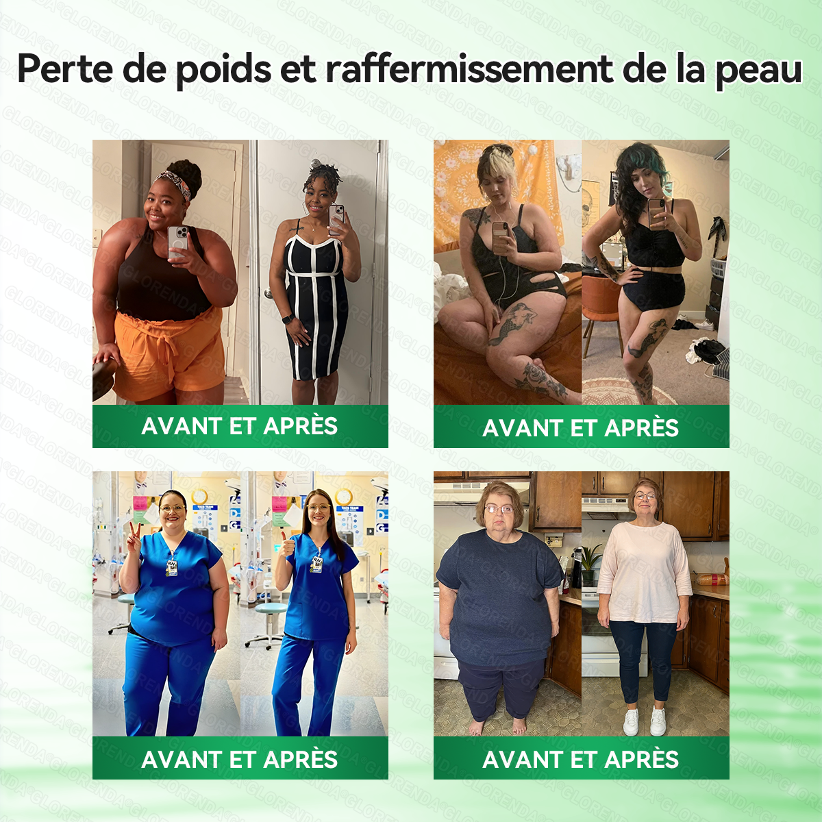 Boutique officielle 🦋🦋𝐆𝐋𝐎𝐑𝐄𝐍𝐃𝐀® Moringa · Berbérine + NAD+ – Patch Microneedle Nano Avancé 10-en-1 (1×/jour, résultats visibles en 7 jours) | Obésité, relâchement cutané, apnée du sommeil, articulations, etc.-LYJ