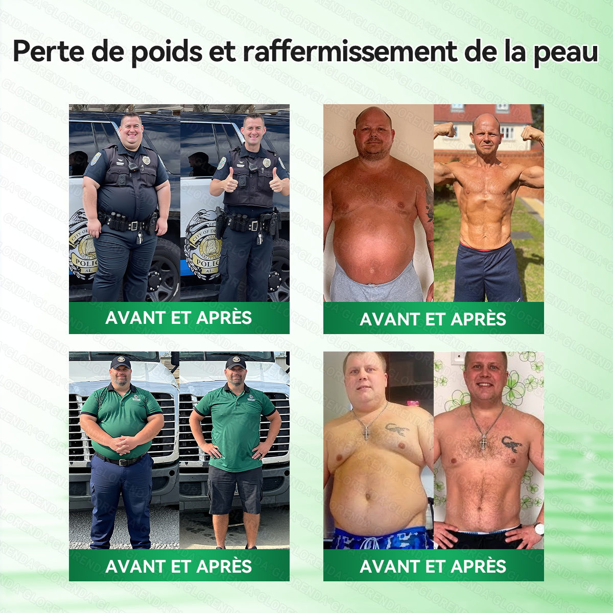 Boutique officielle 🍁🍁𝐆𝐋𝐎𝐑𝐄𝐍𝐃𝐀® Moringa · Berbérine + NAD+ – Patch Microneedle Nano Avancé 10-en-1 (1×/jour, résultats visibles en 7 jours) | Obésité, relâchement cutané, apnée du sommeil, articulations, etc.-LYJ